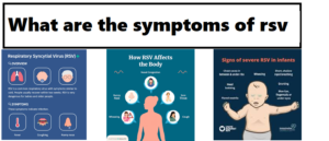 symptoms of rsv